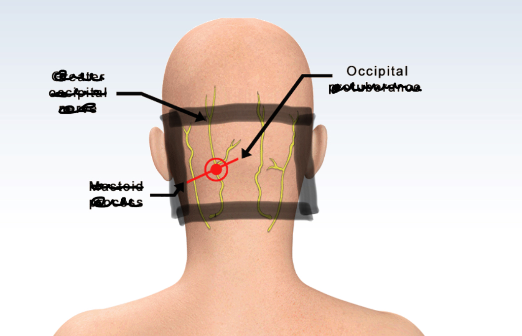 <p>ONLY the back of the head </p>