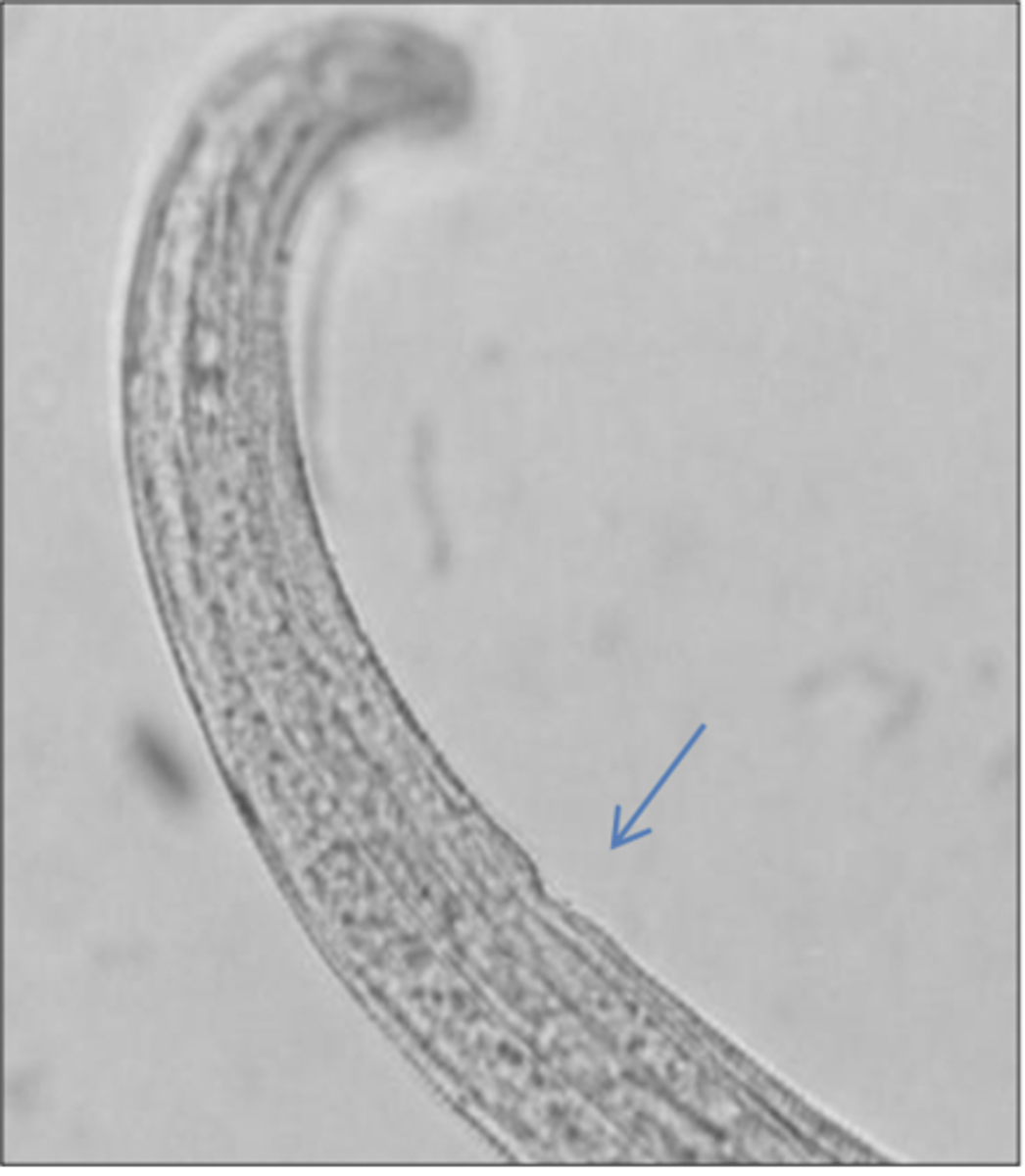 <p>What is this parasite? What characteristic/s did you use to identify it?</p>