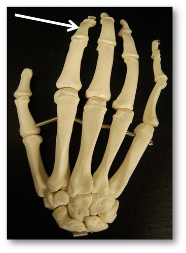 Name this specific bone.