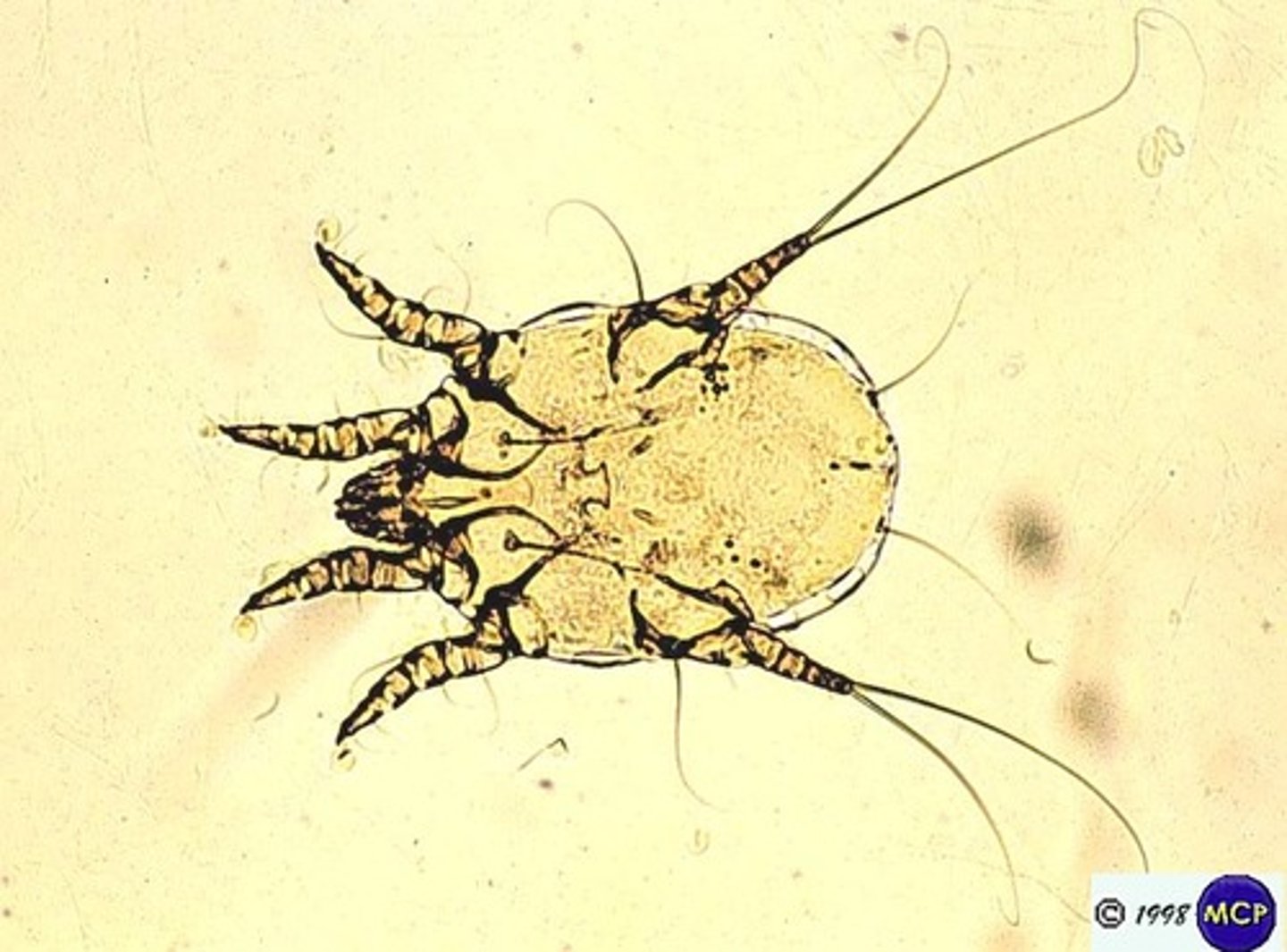 <p>a parasite that may cause mange in animals or scabies in humans</p>