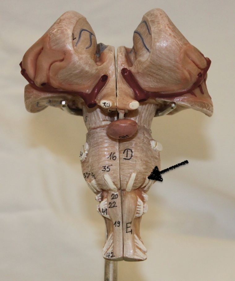 <p>name this cranial nerve</p>
