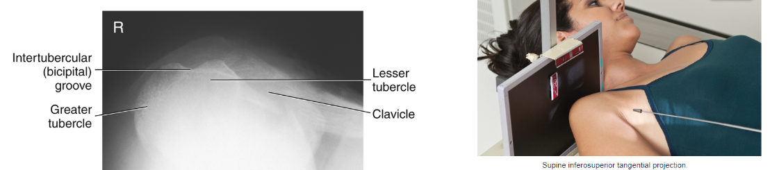 <p>Intertubercular sulcus/groove</p>