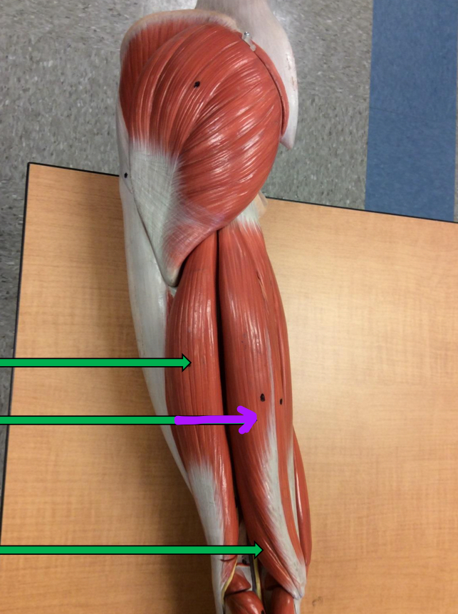 <p>Identify this muscle?</p>