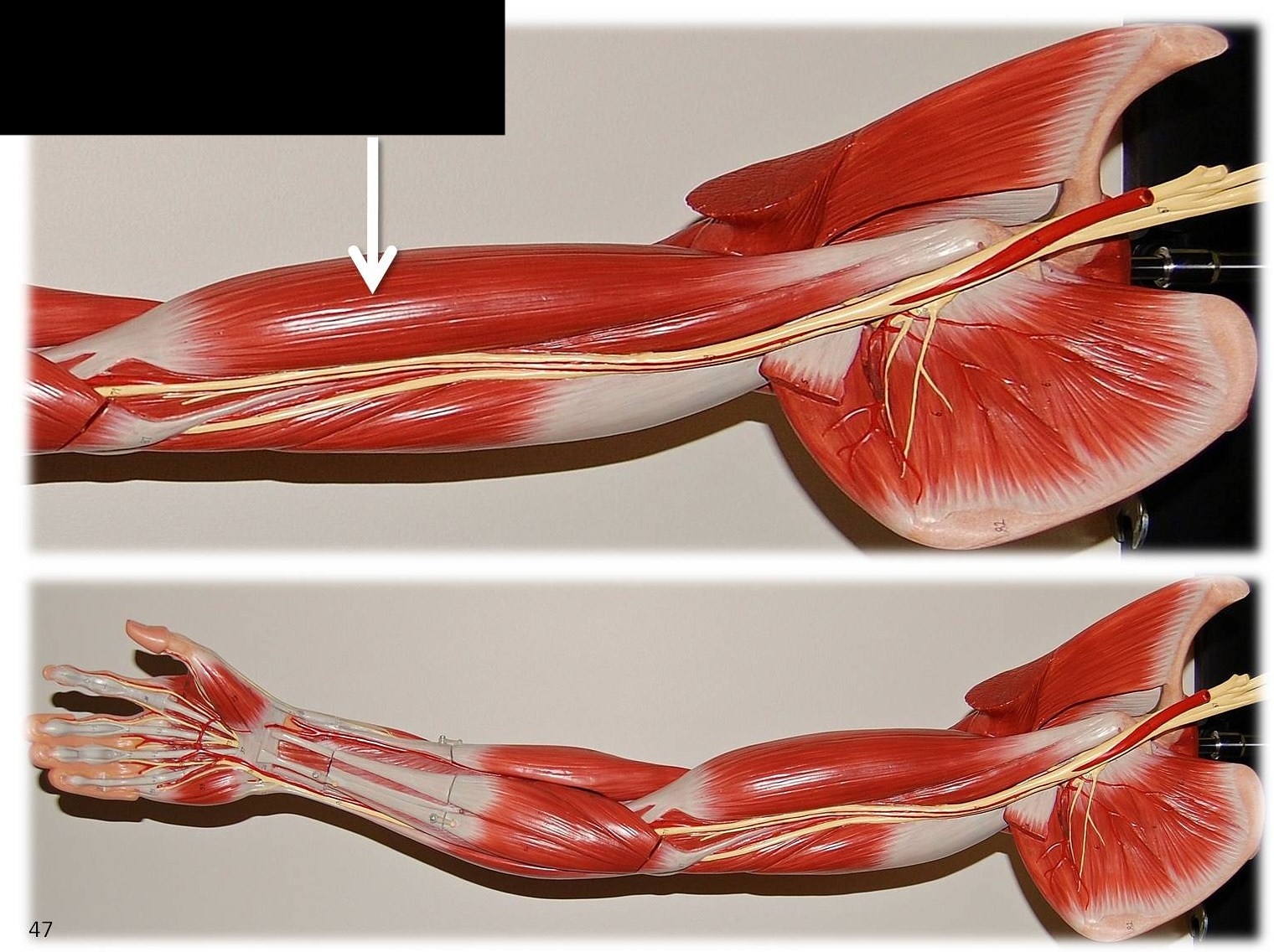 <p>What muscle is this?*****</p>