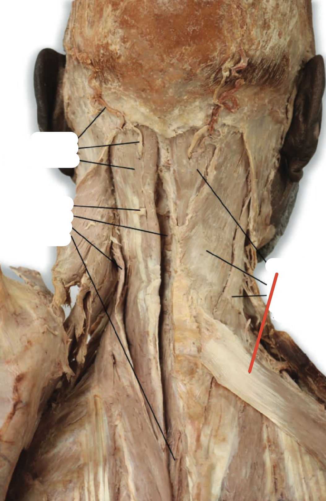 Identify the structure (red line)