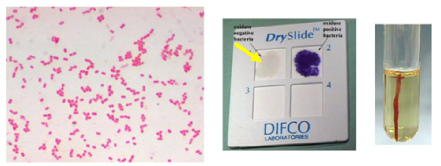 <p>Non-motile "A-cineto"</p><p>Growth on blood, chocolate, MacConkey</p>