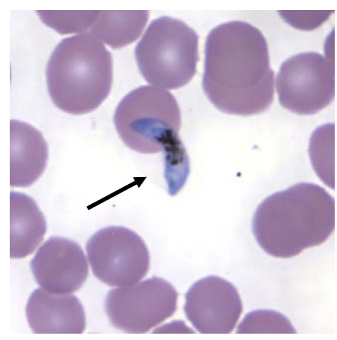 Gametocyte