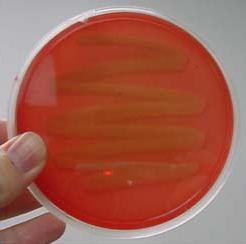 <p>What type of hemolysis is this?</p>
