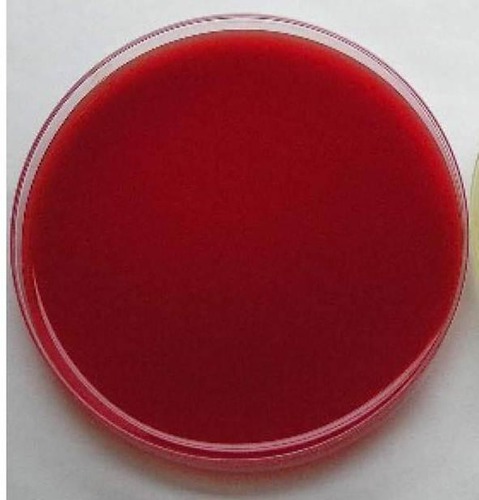 Classification of Blood Agar (BA or BAP)