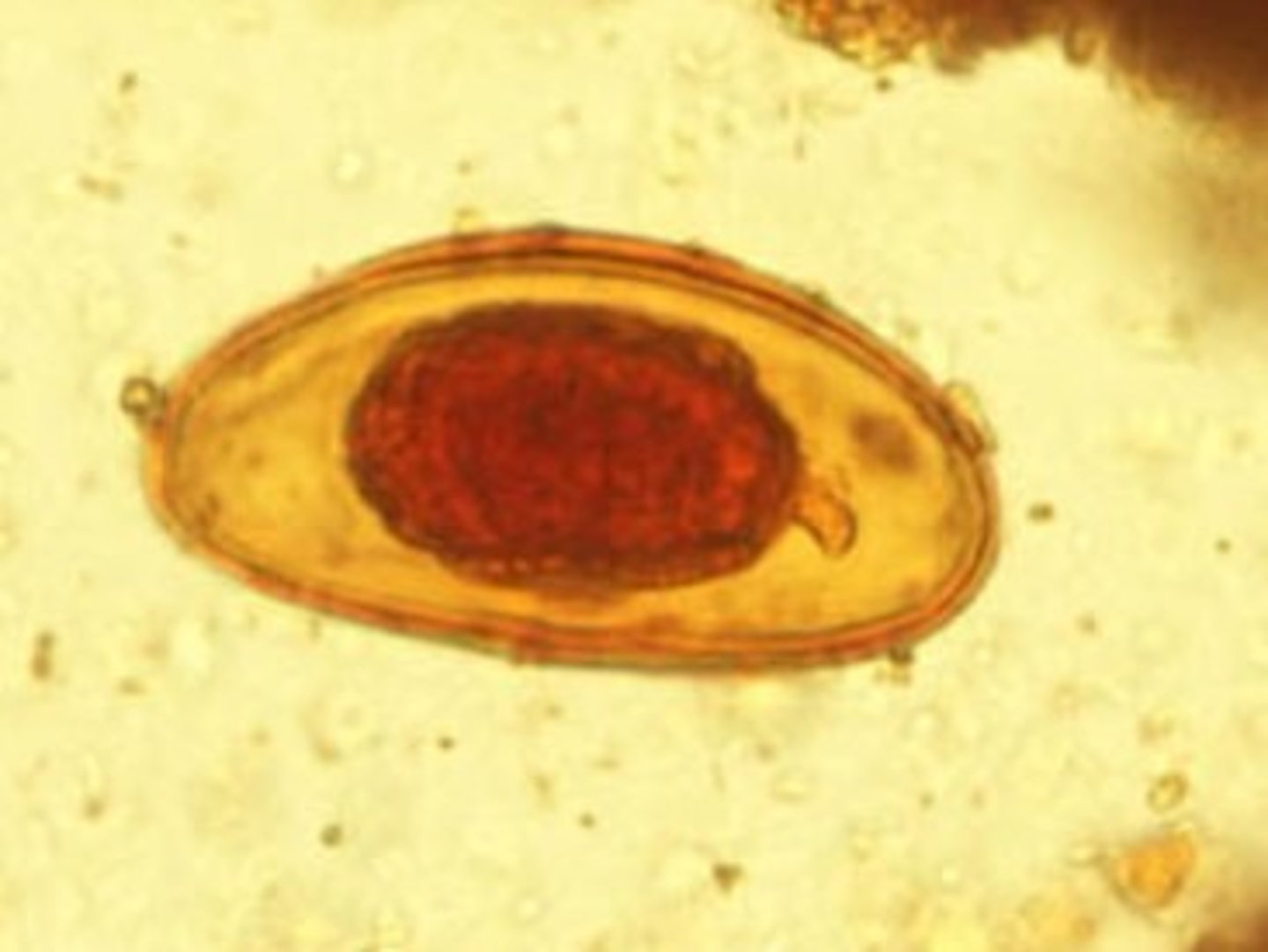 <p>Identify the parasite</p>