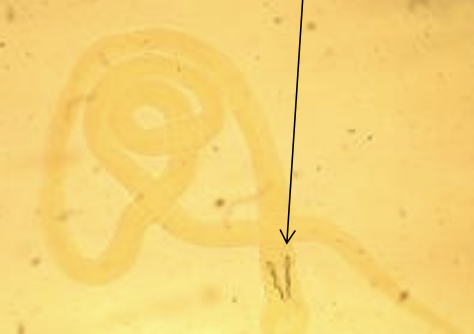 <p><span>Which parasites are shown in this picture, and which morphological feature supports this conclusion?</span></p>