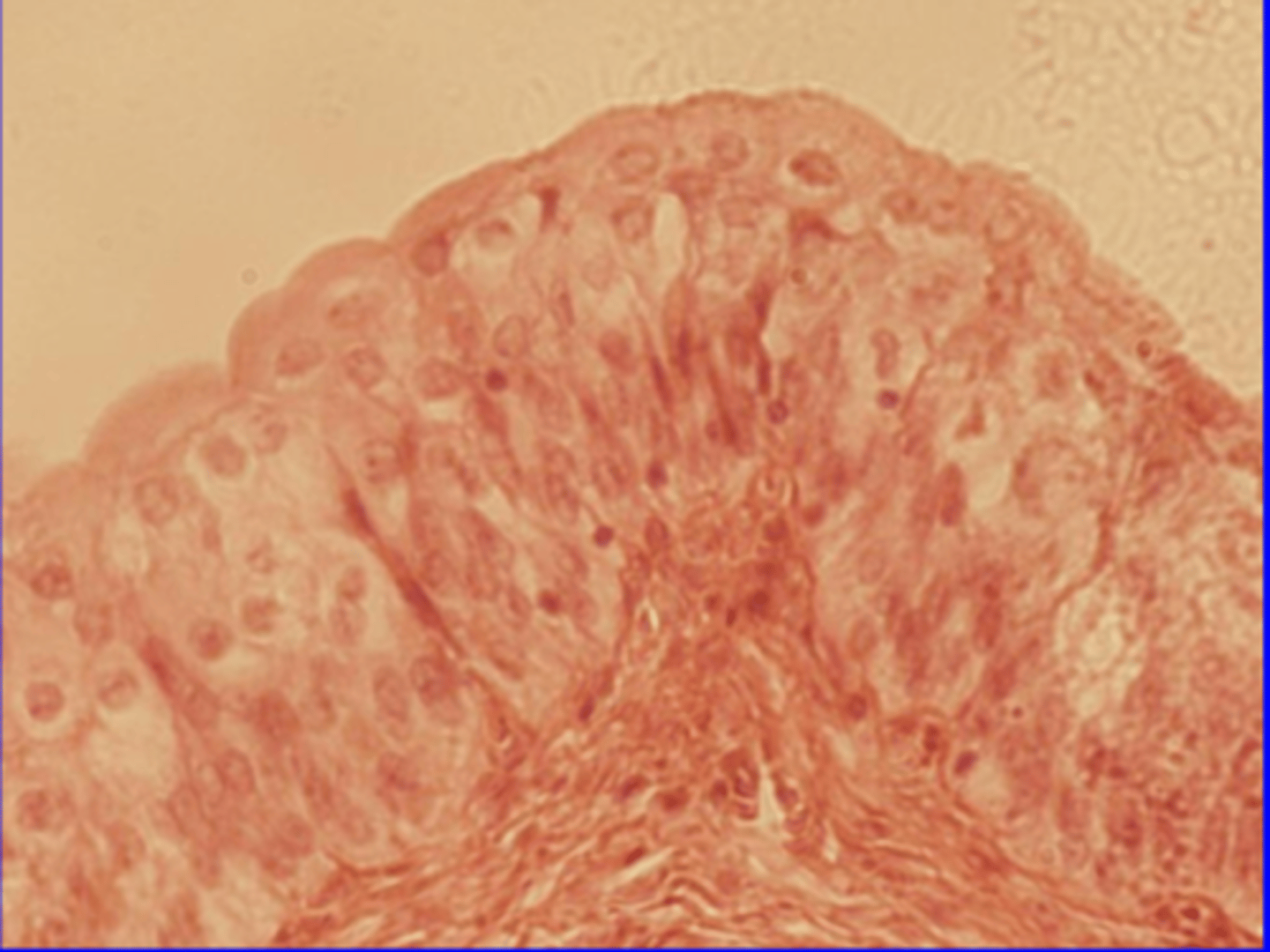 <p>Changes from stratified cuboidal to stratified squamous</p><p>Location: Urinary bladders and ureters</p><p>Function: permits stretch</p>