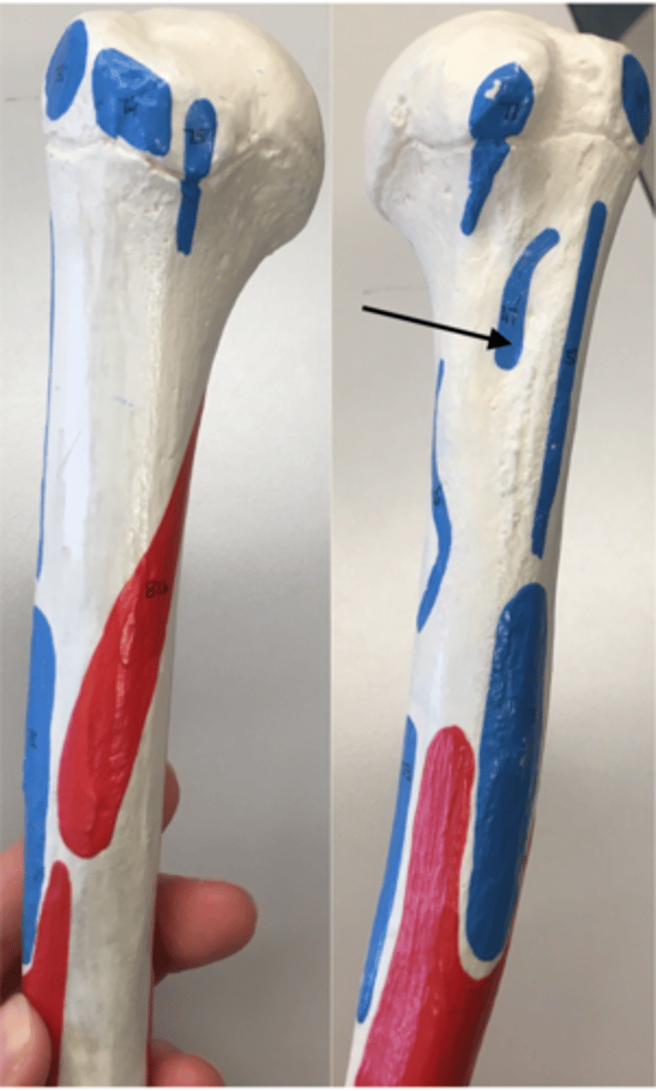 <p>47</p><p>I: Medial lip of intertubercular groove</p>