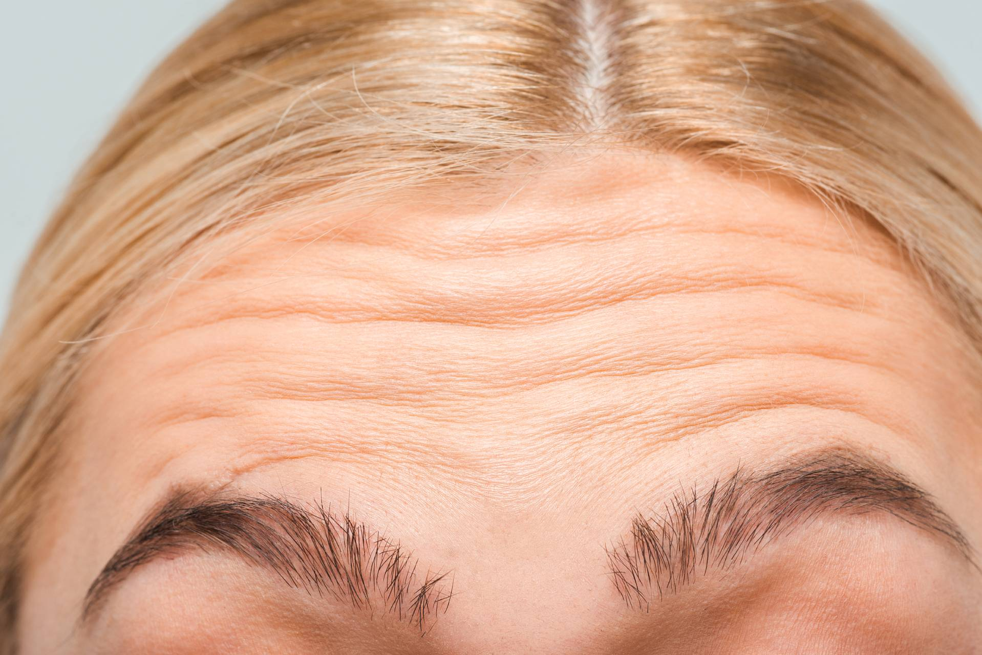 <p>Transverse frontal sulci</p>