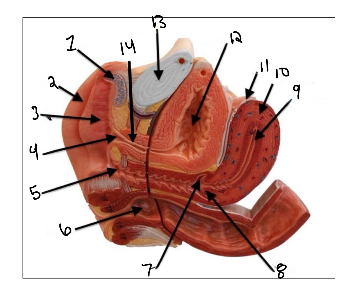 <p>Urogenital diaphragm </p>