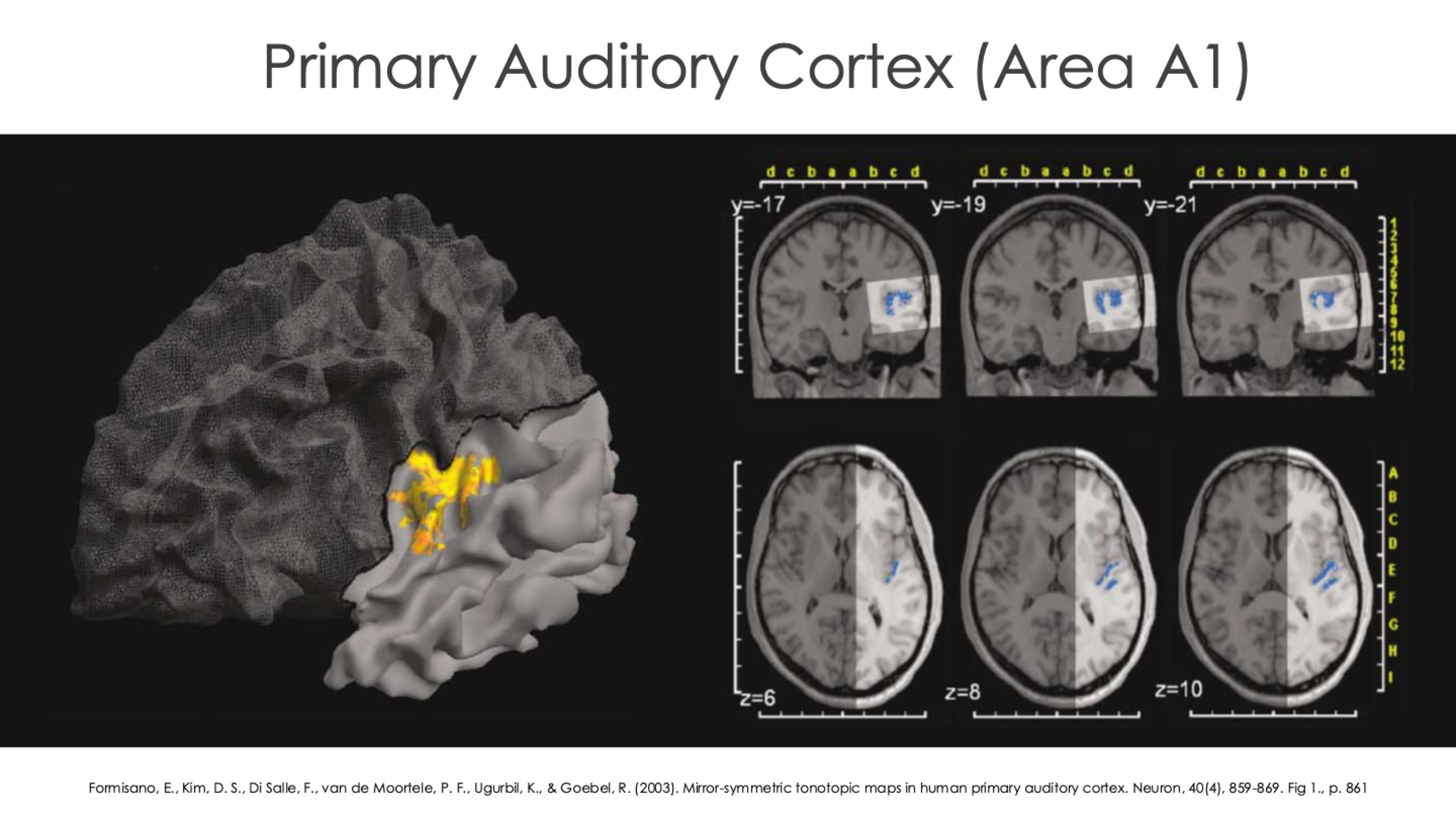 <p>The Auditory Cortex (Area A1)</p>