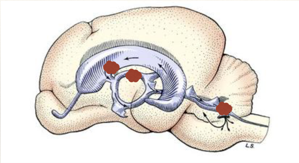 <p>what is depicted by the red marks in this image?</p>