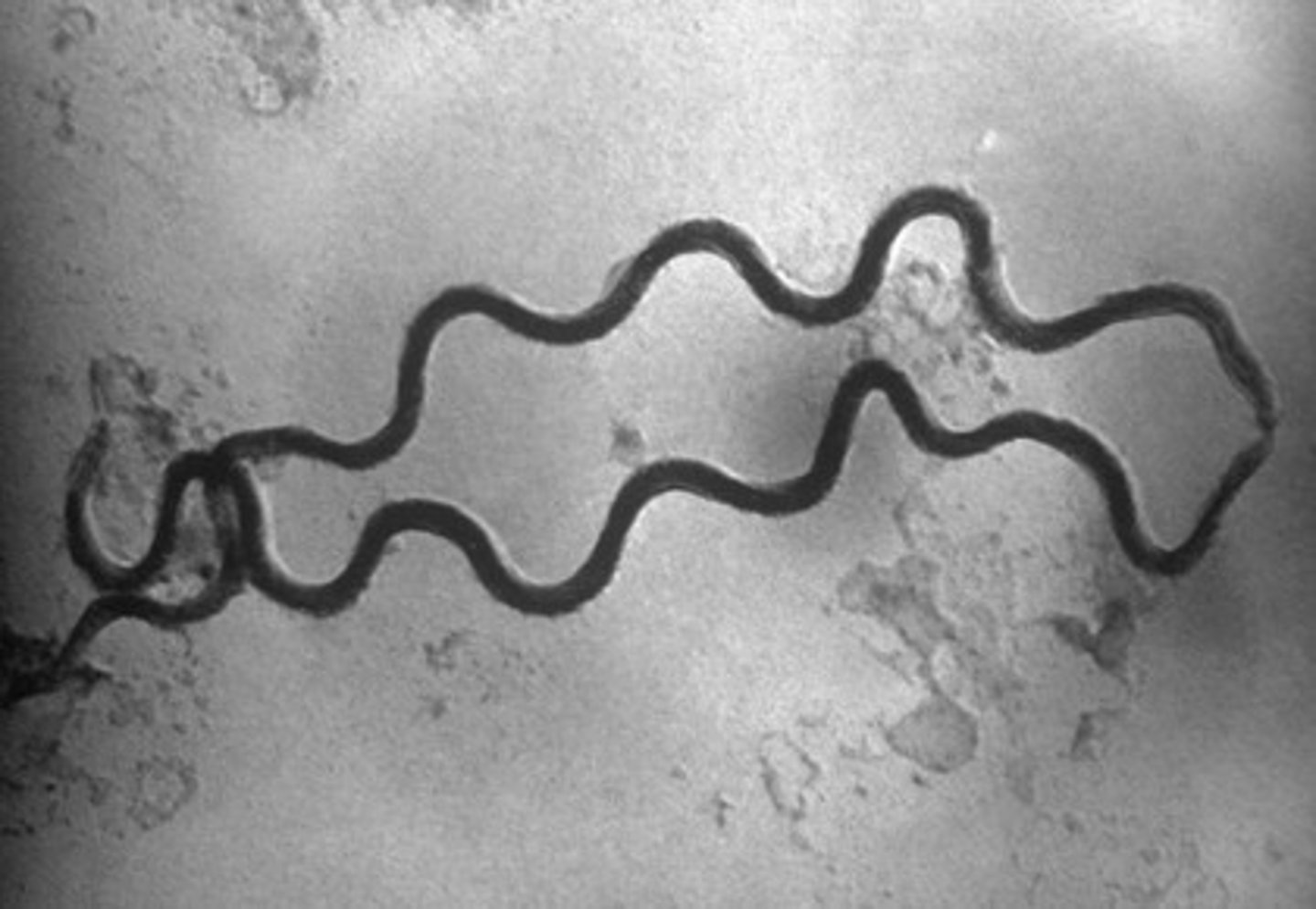 <p>- Cholera (single spiral)<br>- Rat Bite Fever (Corkscrew &amp; Flagellum)<br>- Syphilis (Corkscrew, No flagellum)</p>