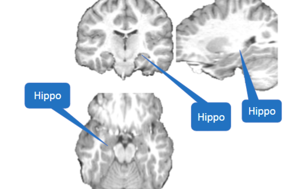 <p>Gray banana = hippocampus</p>