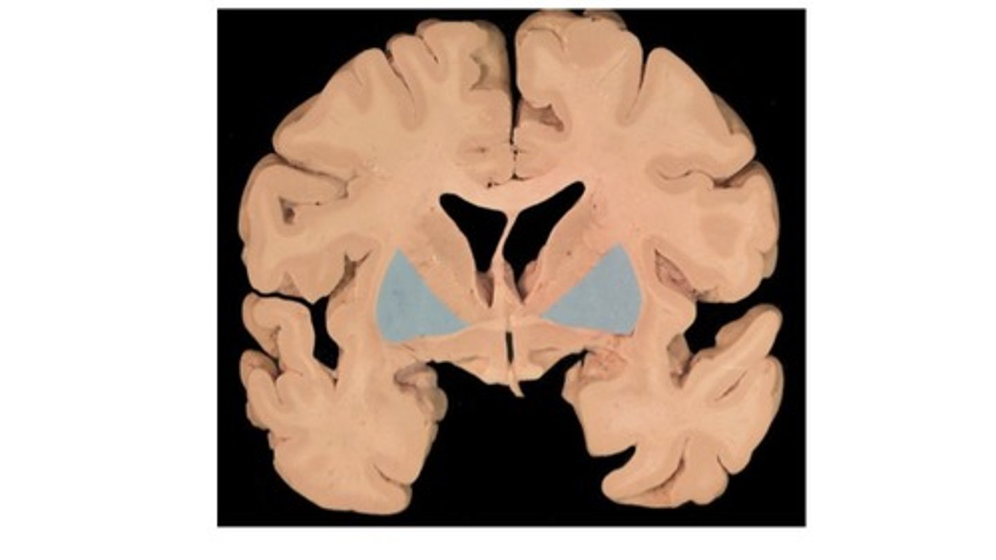 <p>putamen and globus pallidus</p>