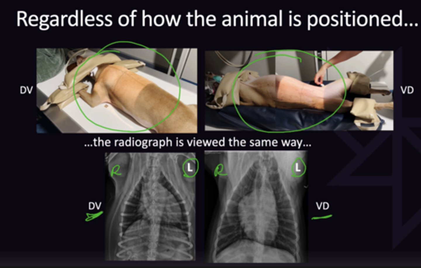 <p>1. for Both Images, View as if in VD (Left side of patient on right of monitor, right side of patient on left of monitor</p>