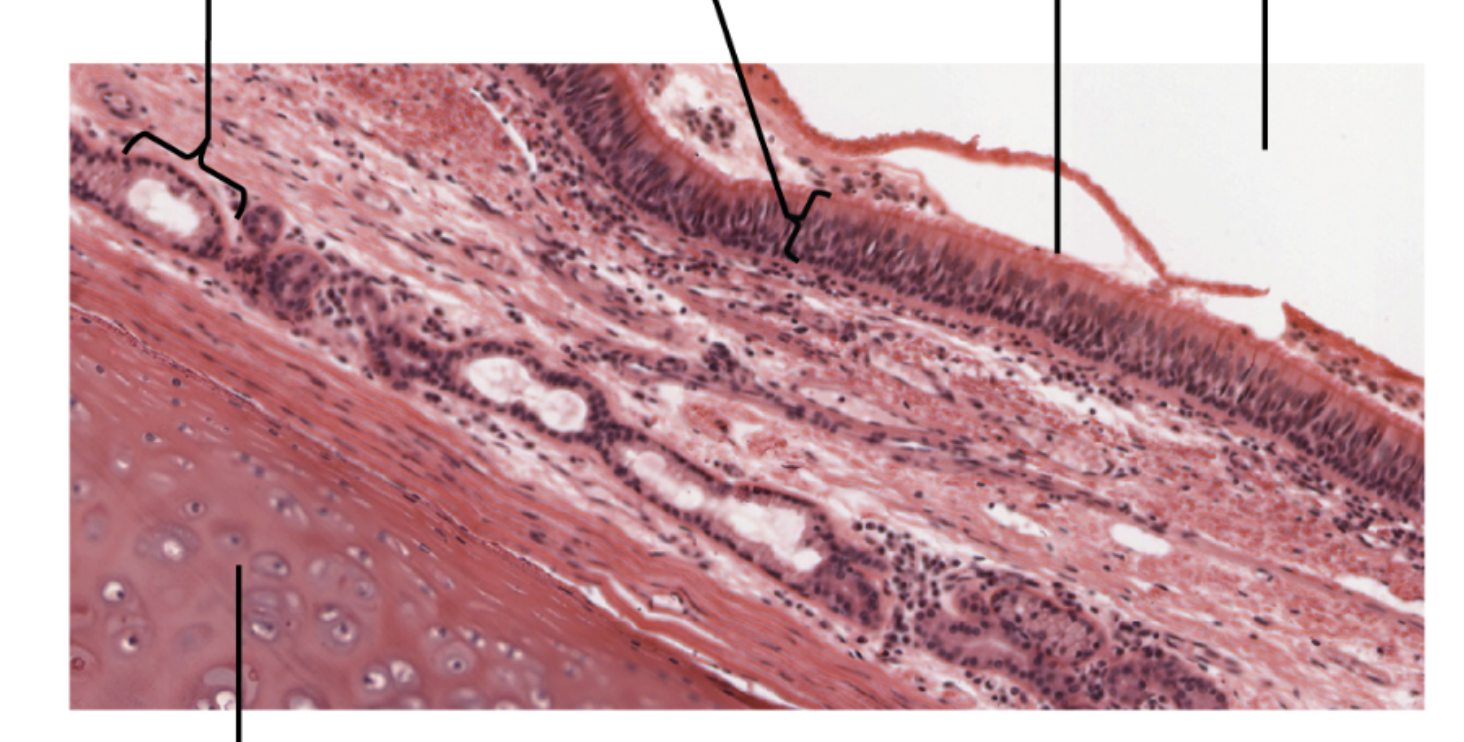 <p>Pseudostratified Ciliated Columnar Epithelial</p><p>Function:&nbsp;protection and secretion / movement of mucus </p><p>Found in: lines airways of respiratory tract, lines glands and ducts </p>