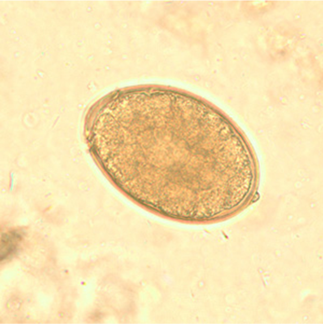 <p>The adults of this pseudotapeworm absorb vitamin B12 to such an extent that it cause significant anemia. The host includes dogs, cats, and humans.  Please name this parasite.</p>
