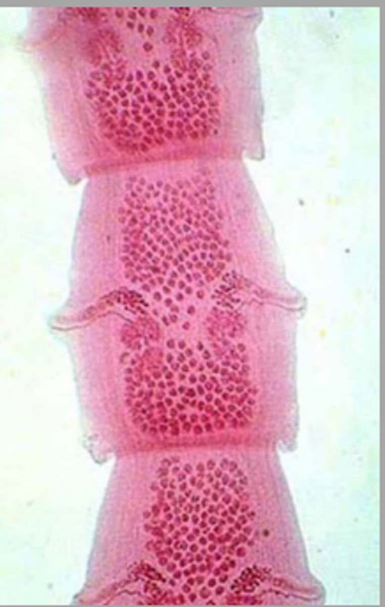 <p>What parasite is depicted in this image of a two genital pore on the proglottid?</p>