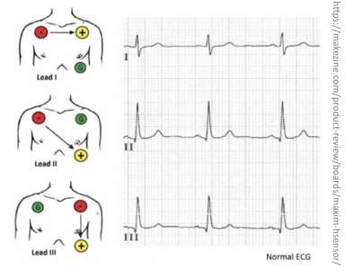 measures changes in electrical signal across cardiomyocytes

\
* as cardiomyocytes depolarize/ repolarize, electrical currents pass across the body 
* electrical impulse picked up by electrodes
  * Voltage measured as a difference between 2 electrodes 
  * toward +ve deflection, away from +ve deflection

 

multiple lead arrangements = many signals and characteristic patterns 