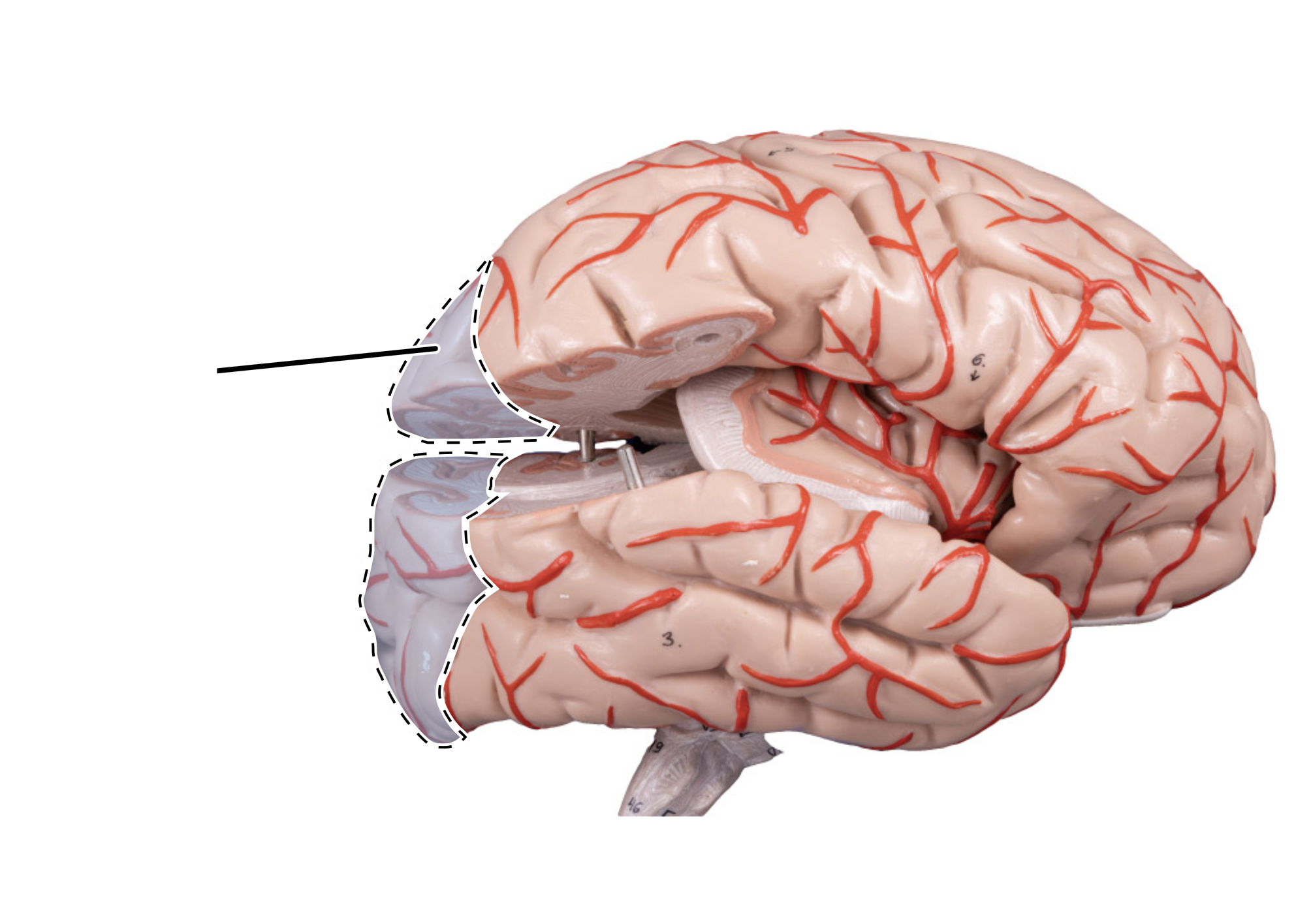 term image