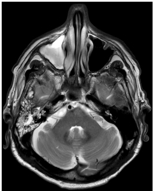 <p>What does this MRI image show, and which phase is this?</p>