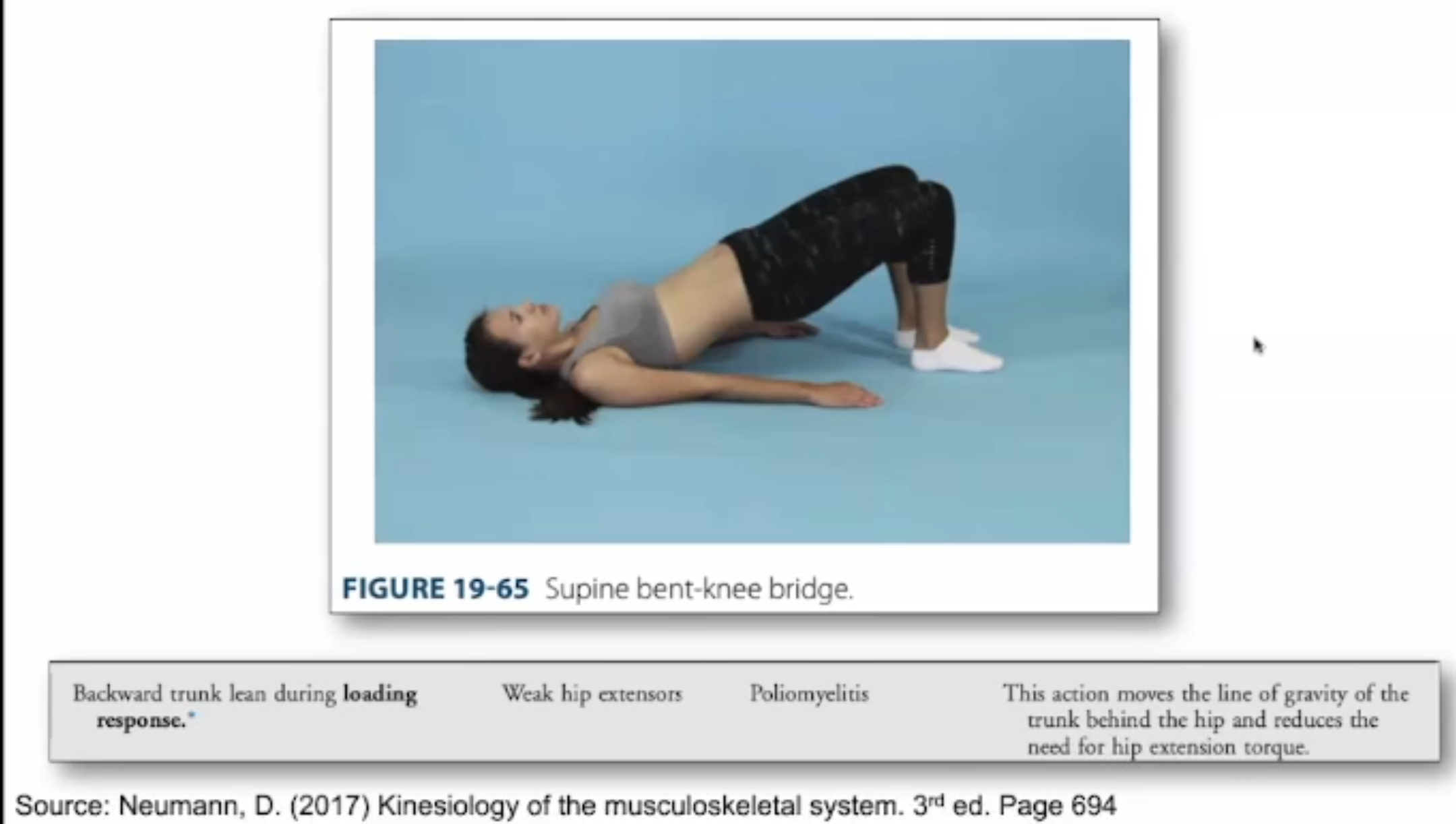 <ul><li><p>B</p></li><li><p>strengthening of hip extensors</p></li></ul><p></p><ul><li><p>A - weak hip flexors</p></li><li><p>D - weak quads</p></li></ul><p></p>