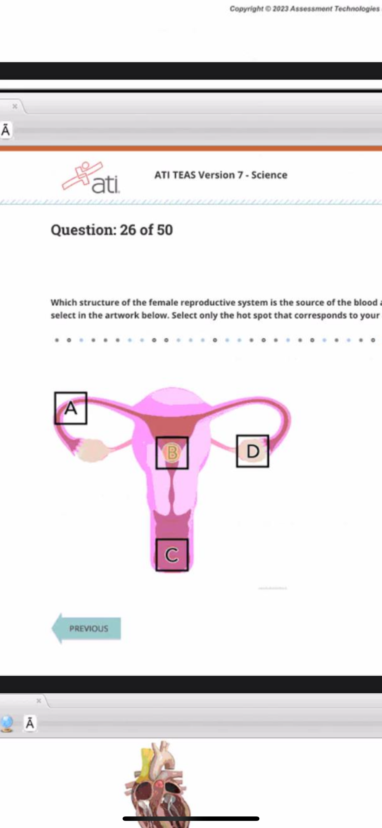 <p>Which structure of the female reproductive system is the source of the blood and mucosal tissue during menstruation? (You will find hot spots to select in the artwork below. Select only the hot spot that corresponds to your answer.)</p>