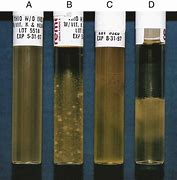 <p>What type of oxygen requirements are A, C, and D</p>