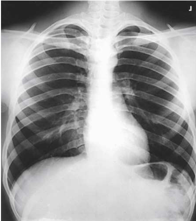 <p>What projection, position and anatomy is this?</p>