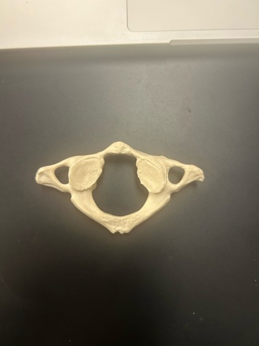 <p>name the bone</p>