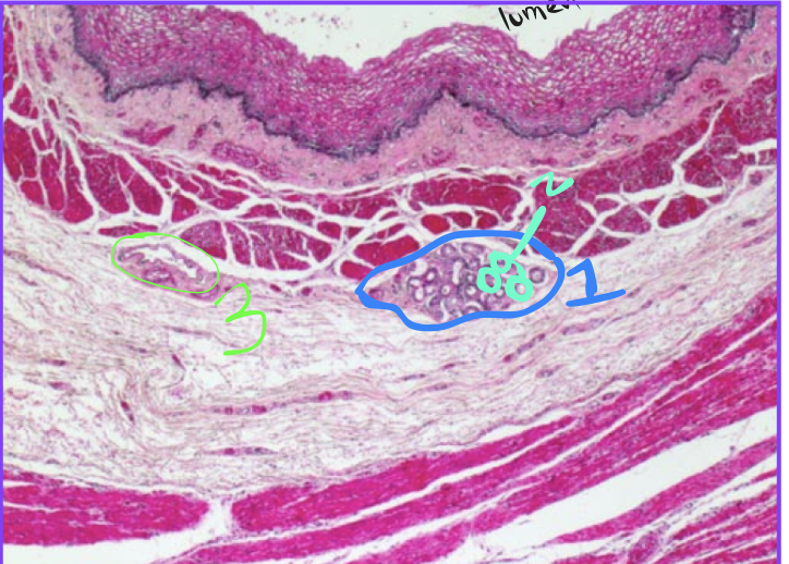 <p>what is the structure at 2</p>