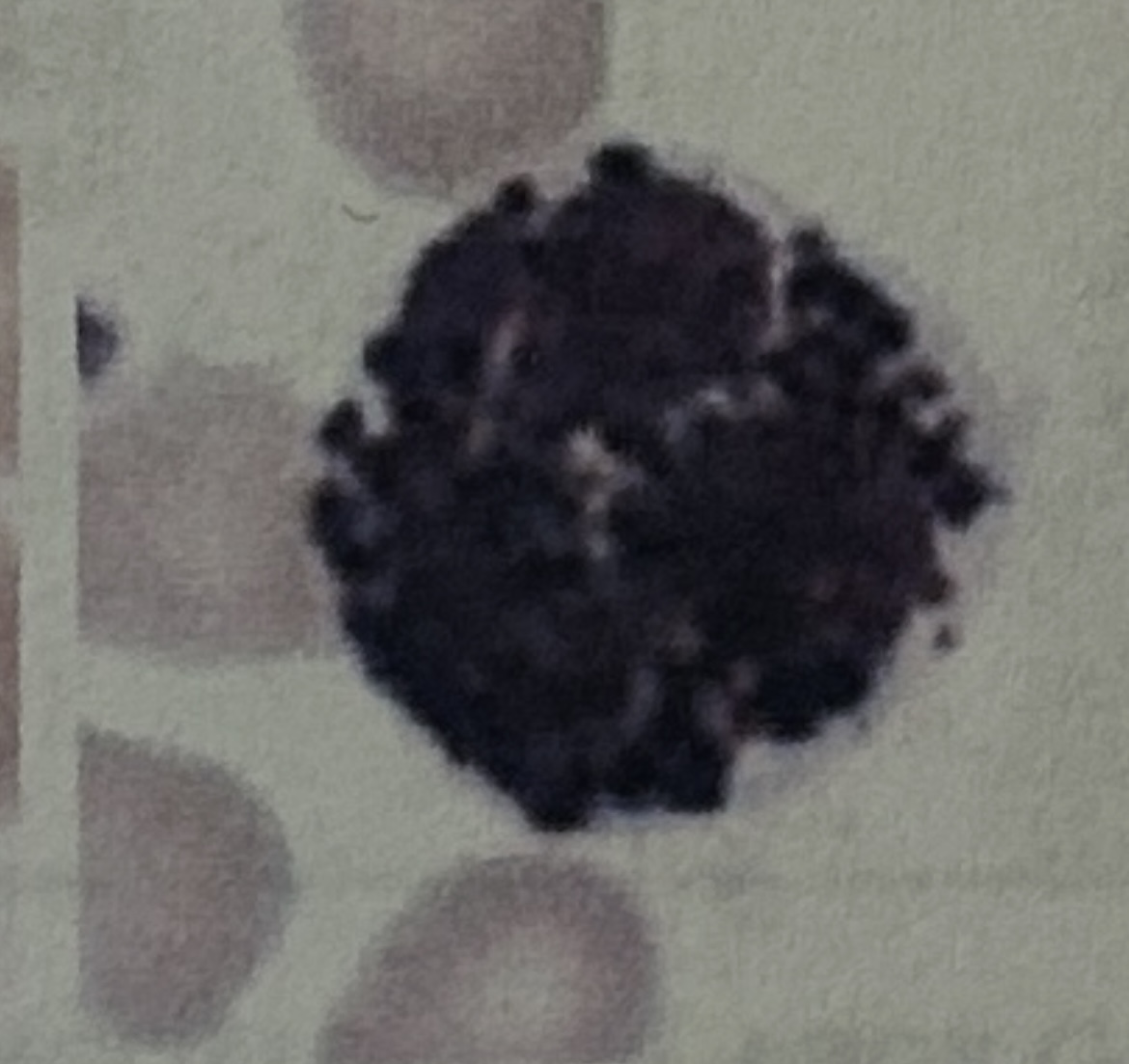 <p>WBC</p>