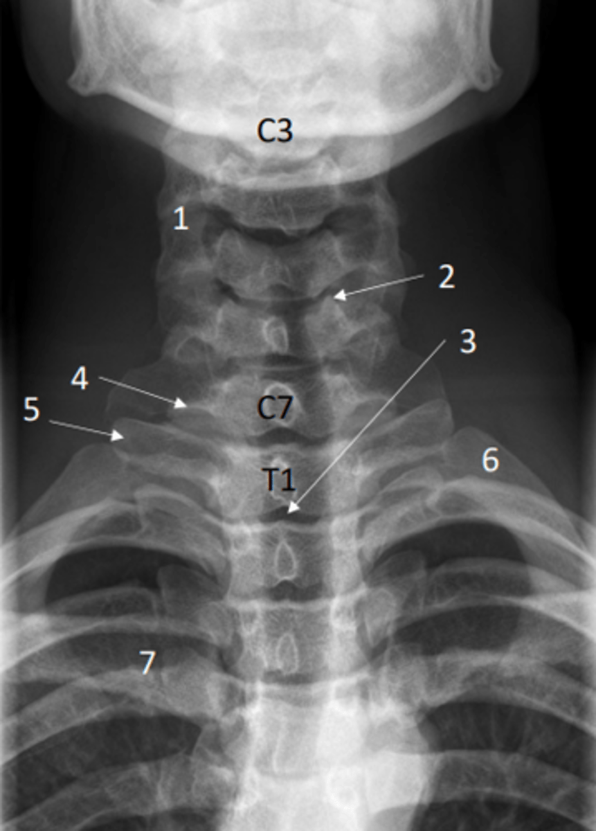<p>6 = First rib</p>