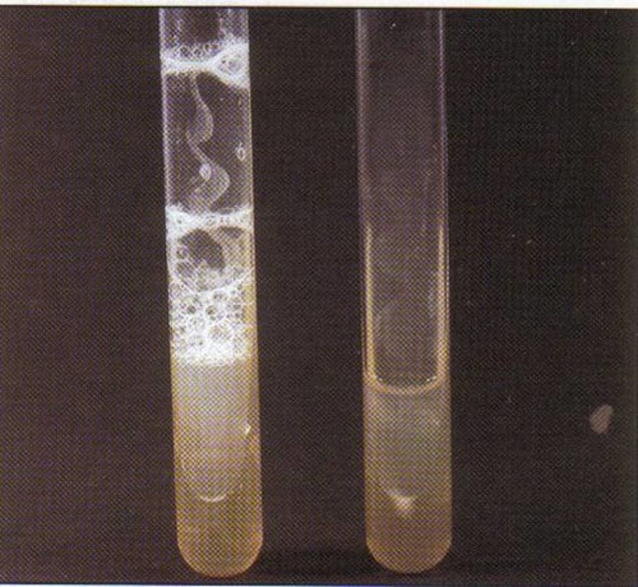 <p>CATALASE TEST</p><p>If bubbling occurs after adding hydrogen peroxide, is the organism positive or negative for catalase?</p>