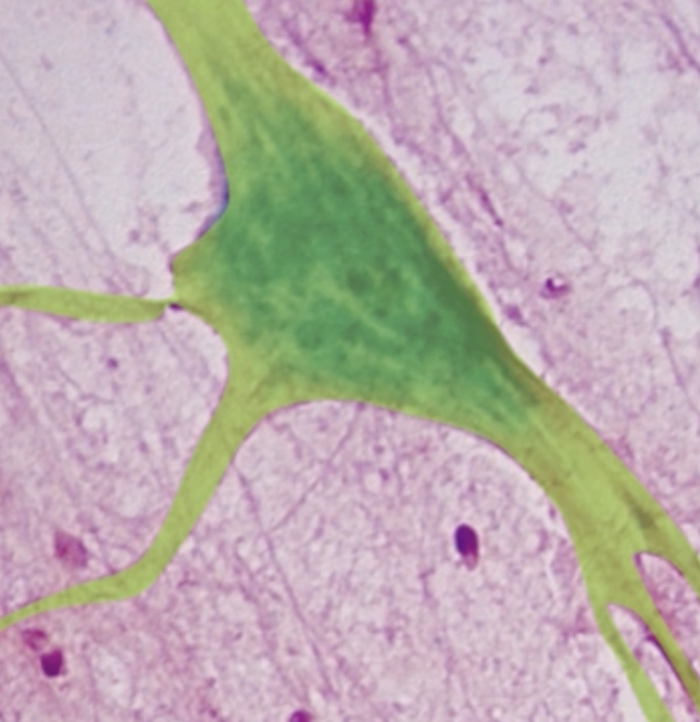 <p>What type of cell is highlighted in green?</p>