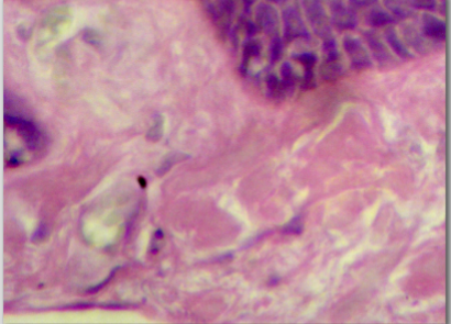 <p>allows organs (such as the skin) to be pulled in any direction; withstands considerable tensile strength from many directions </p>