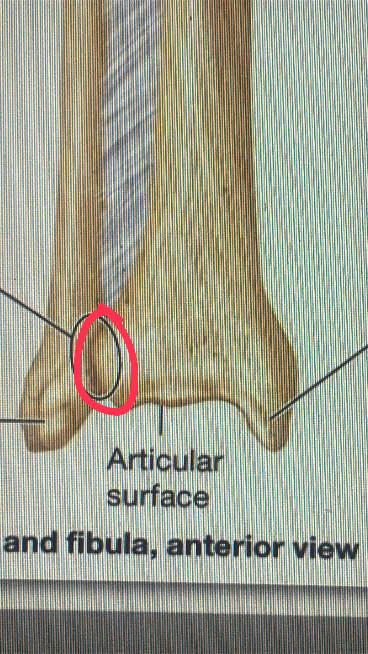 <p>outer bulb of the distal epiphysis of the fibula</p>