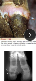 <p><span>Sepsis of the Distal Interphalangeal Joint (DIP)</span></p>