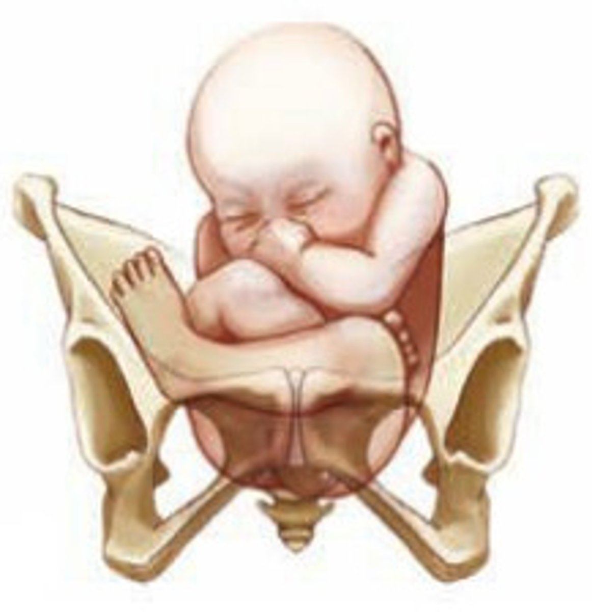<p>In which quadrant of the mother's abdomen (anatomical position) would you place your stethoscope to listen to the FHR if the fetus presents in complete breech</p>