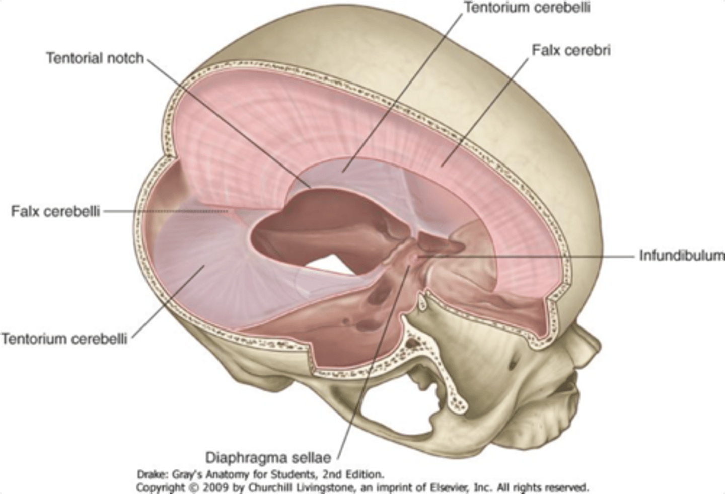 <p>falx cerebri <br>- stabilizes brain from forces from sides</p>