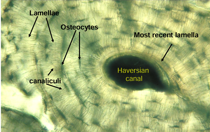 <p>-one haversian system (osteon)</p>