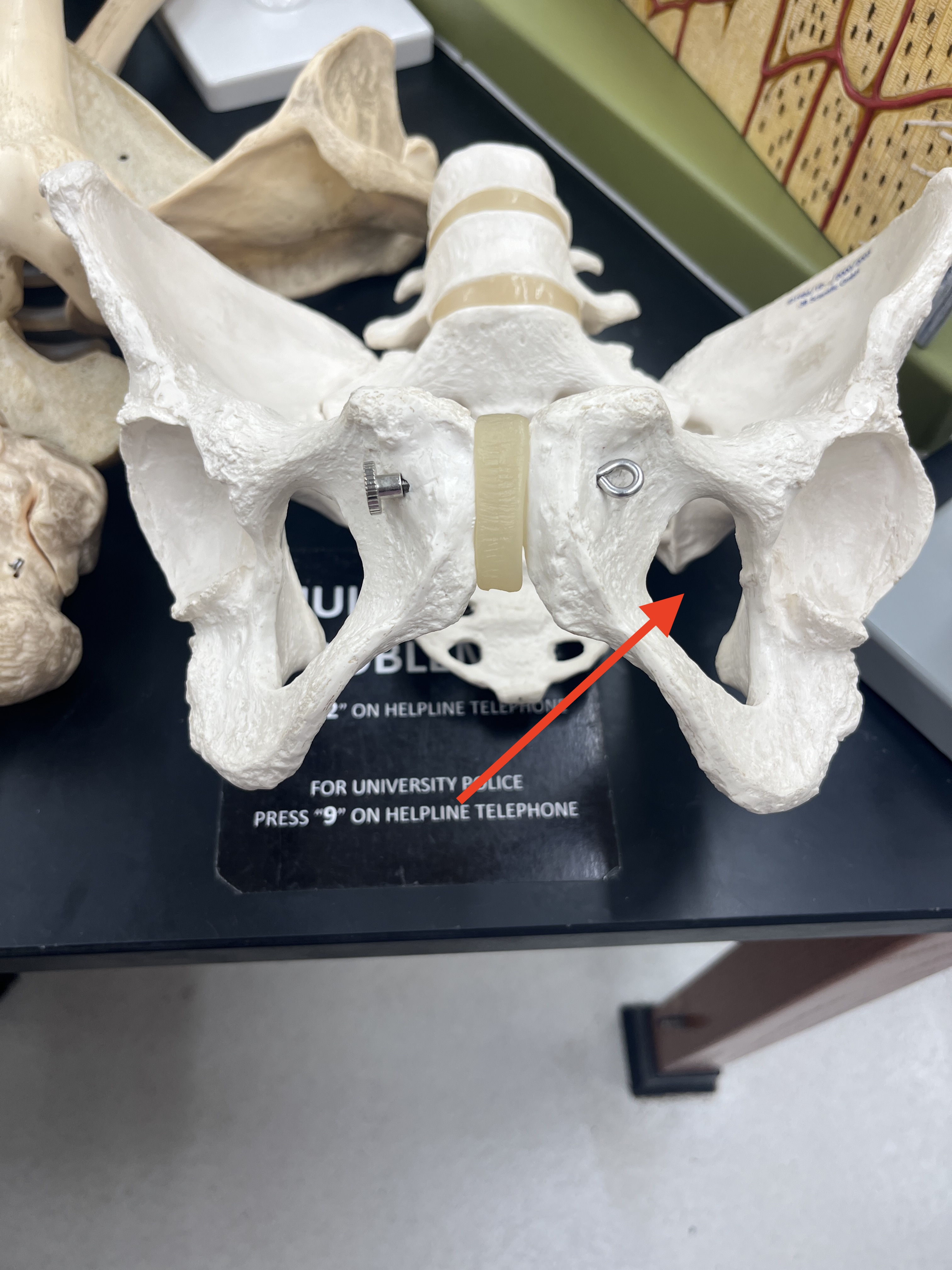 term image