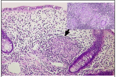 term image