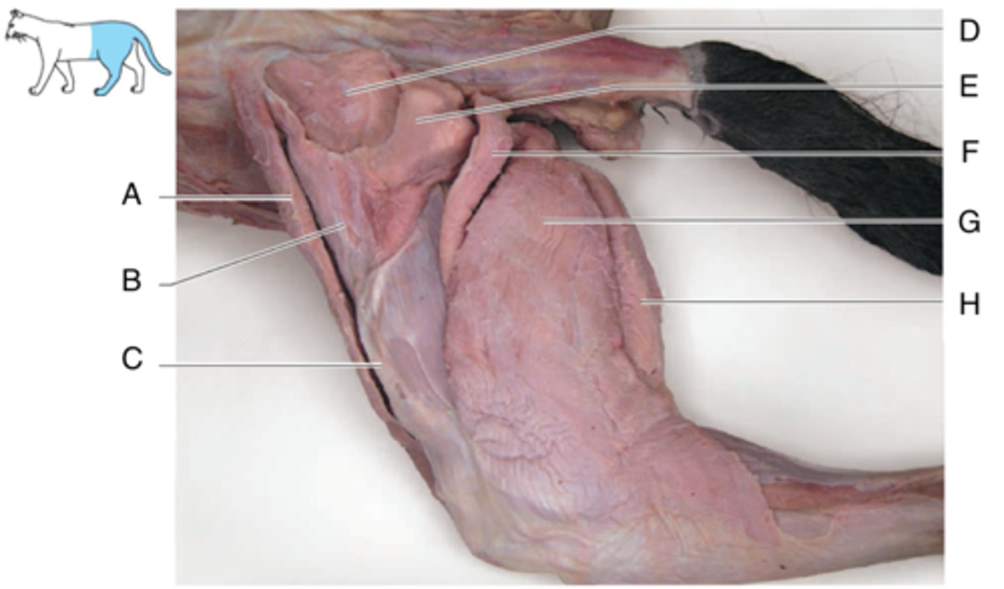 <p>What is the muscle indicated by letter H? What is an attachment point and function?</p>